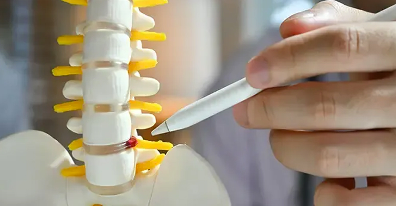 Discus Injuries Disc Injury Pain Relief Cedar Park, TX | Bell District Spine and Rehab