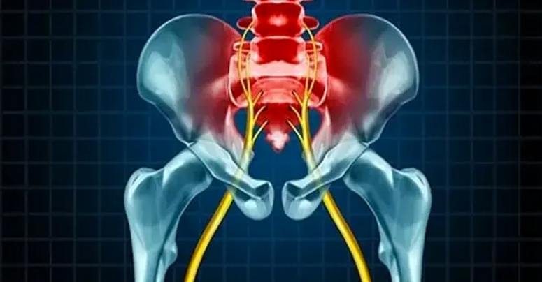 Sciatica Pain Relief Cedar Park, TX | Bell District Spine and Rehab