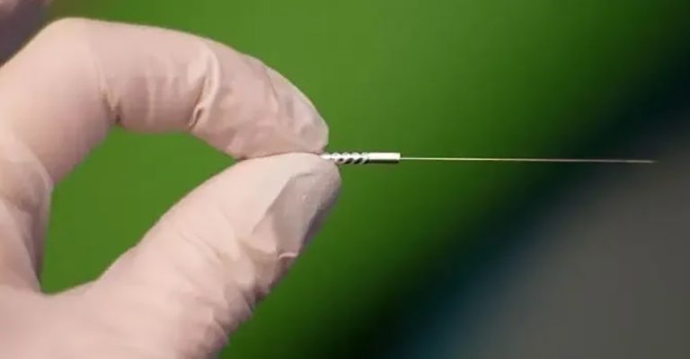 Filiform Needling Functional Dry Needling Cedar Park, TX | Bell District Spine and Rehab